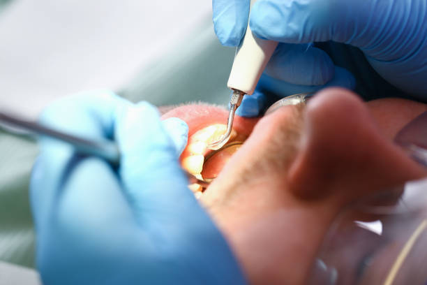 Best Emergency Tooth Extraction in Rio, VA
